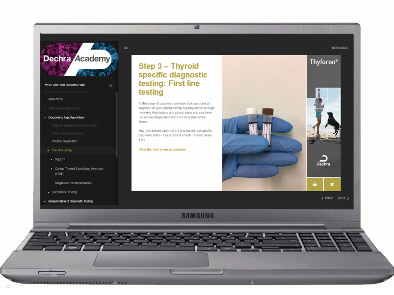 CPD for Hypothyroidism